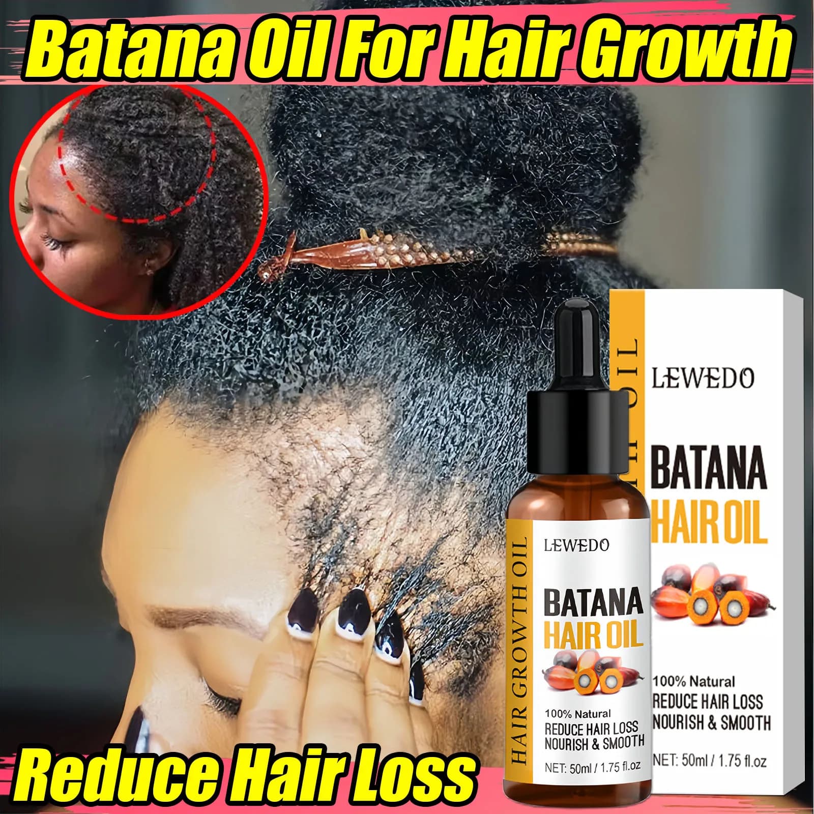 Batana-Öl, Haarwachstumsprodukte, schnelles Wachstum, Batana-Essenzöl, Traktion, Alopezie, Anti-Haarausfall, Kahlheitsbehandlung für Männer und