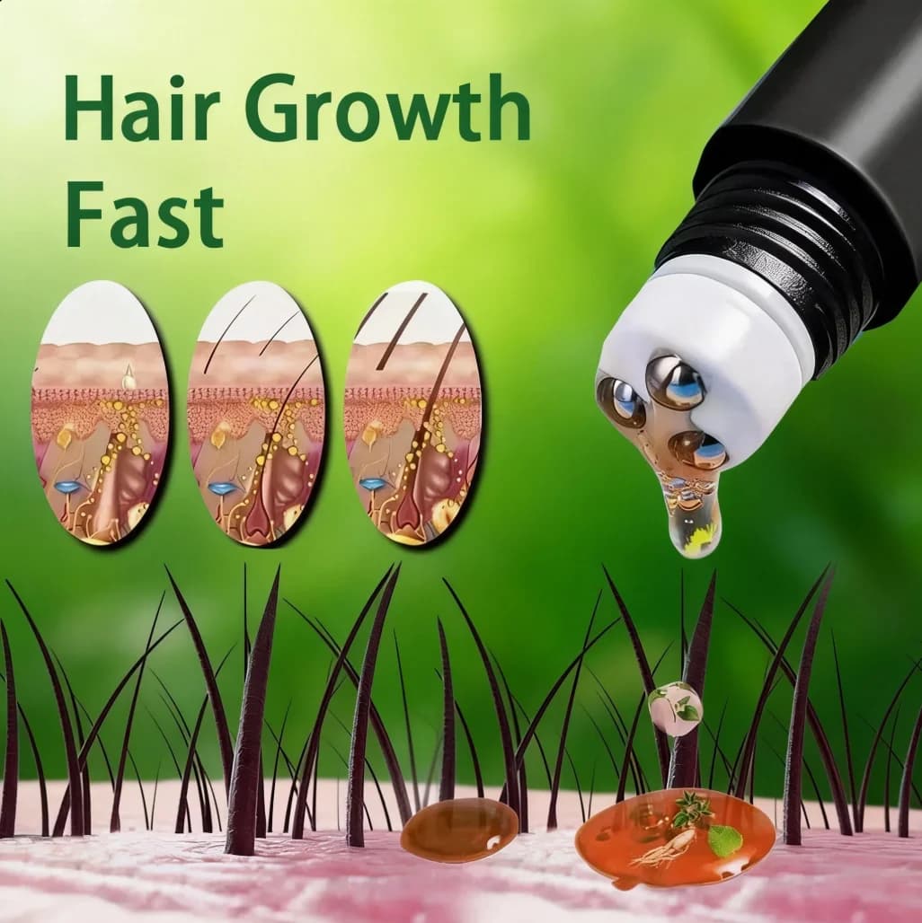 Biotin Schnelles Haarwuchsöl Produkte Pflege Kopfhaut-Massage-Behandlungen Anti-Haarausfall Effektives Haarwachstums-Serum für Männer