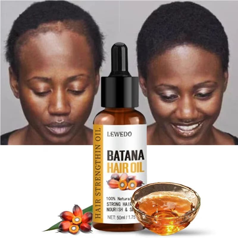 Lewedo Naturals Batana-Öl, schnelles Haarwachstum für Männer und Frauen, reines Batana-Öl, nährt glänzendes Haar, gesunde Haarpflege,