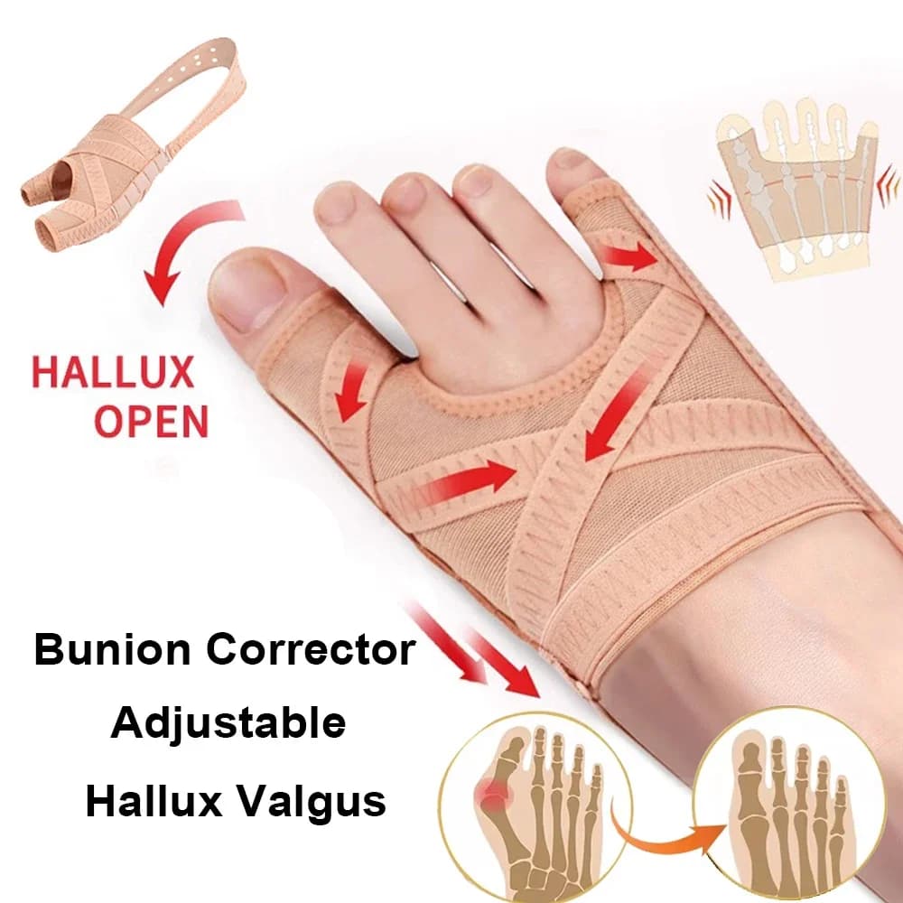 Verstellbarer Hallux-Valgus-Bunion-Korrektor, Zehenspreizer, Orthopädie-Erreger zur Fußknochenkorrektur, Daumenstrecker, Pediküre-Fußpflege-Tools,