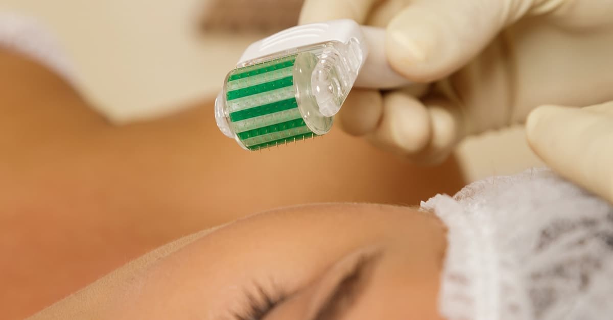 Wertgutschein Bio-Microneedling bei H M Biovital
